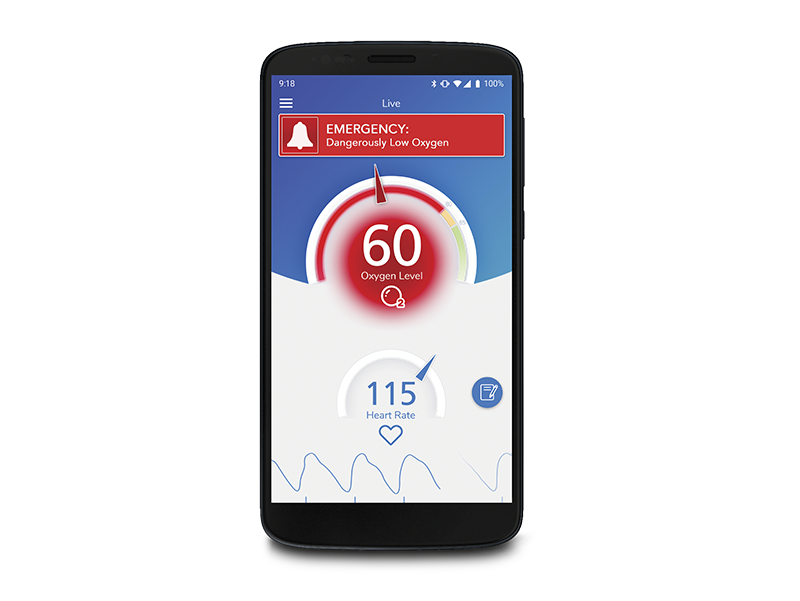 Notfall-Bildschirm der Masimo SafetyNet Alert-App
